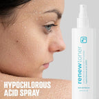 BRIOTECH Skin Renew Toner, Hypochlorous Acid Spray Topical Skin Spray for Face and Skin, Minimize Appearance of Blemishes, Soothing Mist for Redness & Bumps, 4 fl oz