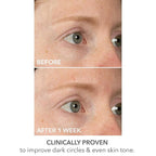 Dr dennis gross derminfusions lift