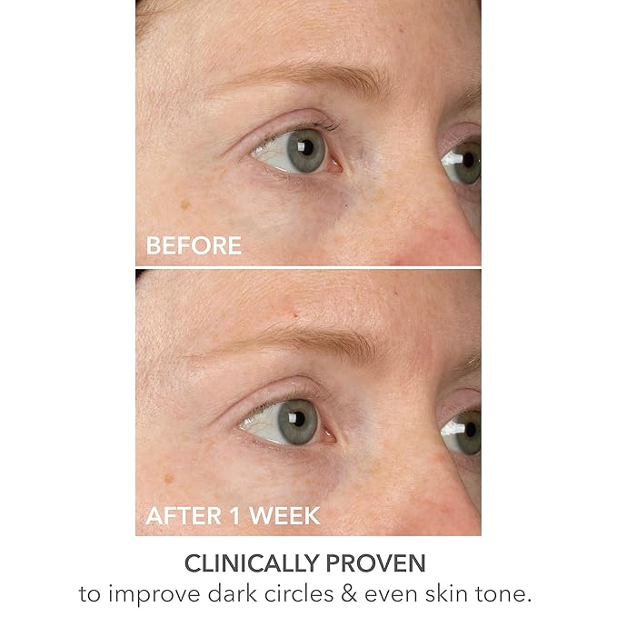 Dr dennis gross derminfusions lift