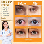 Serfeymi 16 packs steam eye