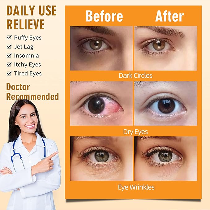 Serfeymi 10 packs steam eye