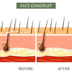 Luseta Tea Tree & Argan Oil Detangling Shampoo & Conditioner Set, 2 x 33.8 Oz