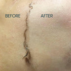 Dermaplane Kit for Women with Dry Skin - Face Shaving Oil and Razor Set - Non Comedogenic, Fragrance Free, Natural and Lightweight by Ouiloe