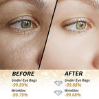 Golden Glow Under Eye Patches for Puffy Eyes - 60Pcs Eye Gels Rejuvenating Treatment for Dark Circles, Puffiness, Refreshing,Revitalizing Looks Less Tired