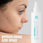 BRIOTECH Renew Toner, Hypochlorous Acid Spray, Minimize Appearance of Blemishes, Soothing Facial Mist for Sensitive Skin, Calm Redness & Bumps, Hypoallergenic & Vegan, 2 fl oz Travel Size (2)