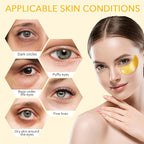 Under Eye Patches, Gold Eye Patches for Puffy Eyes and Dark Circles 24k Gold Under Eye Mask for Wrinkles Eye Bags for Women and Men Collagen Skincare Treatment (20pcs)