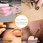 Tweezers For Ingrown Hair By The Razor Bump Co. | Sharp, Stainless Steel, Surgical | Professional Tweezers For Women and Men | Precision Splinter Remover | Best Facial Hair and Eyebrow Trimmer | Black