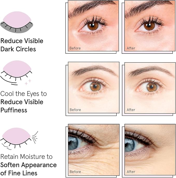 grace & stella Award Winning Under Eye Mask Reduce Dark Circles, Puffy Eyes, Undereye Bags, Wrinkles, Gel Under Eye Patches, Birthday Gifts for Women - Vegan Cruelty-Free Self Care (24 Pairs, Blue)