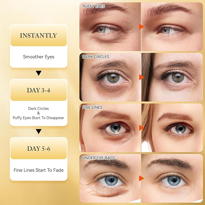 Under Eye Patches for Dark Circles and Puffiness, 60Pcs Under Eye Mask for anti Wrinkles & anti Aging, 24K Gold Eye Gel Pads with Collagen to Reduce Eye Bags, Puffy Eyes Treatment, Hydrating Eye Mask