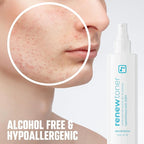 BRIOTECH Renew Toner, Hypochlorous Acid Spray, Minimize Appearance of Blemishes, Soothing Facial Mist for Sensitive Skin, Calm Redness & Bumps, Hypoallergenic & Vegan, 2 fl oz Travel Size (2)