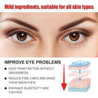 Retinol eye stick, retinol eye