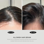 Advanced Hair Serum - 95 ml Scalp Treatment for Fuller, Nourish, Glossy Hair | Prevents Frizz, Promotes Healthy Scalp & Strengthens Roots, Reduces Oil & Buildup