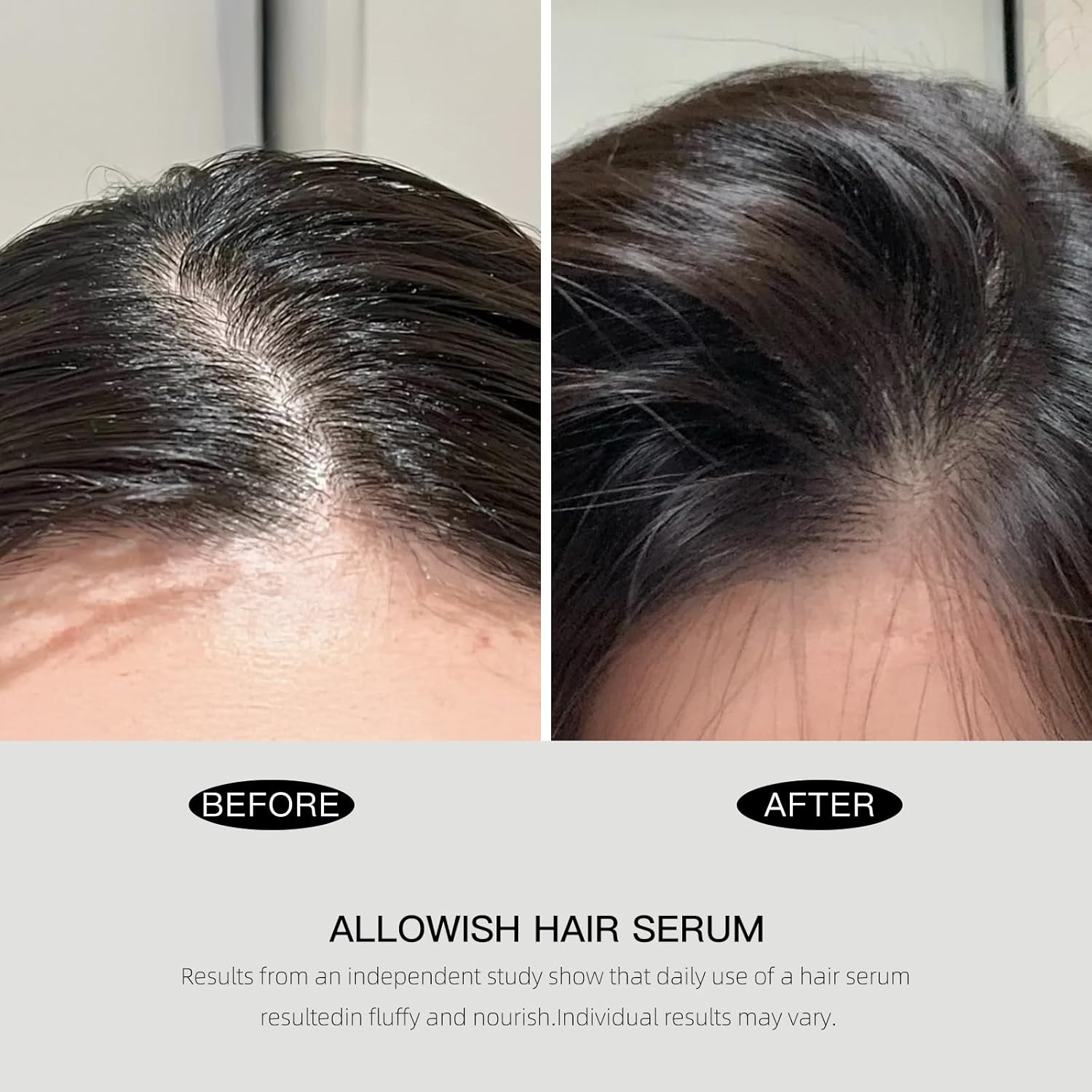 Advanced Hair Serum - 95 ml Scalp Treatment for Fuller, Nourish, Glossy Hair | Prevents Frizz, Promotes Healthy Scalp & Strengthens Roots, Reduces Oil & Buildup