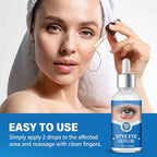 Stye Eye Treatment, Stye Eye Serum for Styes Chalazion and Blepharitis, Gently Cleanses Lashes and Eyes, Restore Healthier Eye Skin, 1 Fl.oz