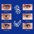 Gel ice pack reusable cooling