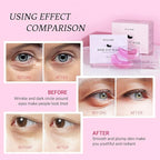 Under eye patchs (30 pairs)