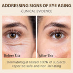 Vitality-Fill Boosting Eye Cream, Natural Anti Aging Under Eye Cream Lift & Firm,Reduce Wrinkles,Fine Lines,and Under Eye Bags,Dark Circles Under Eye Cream