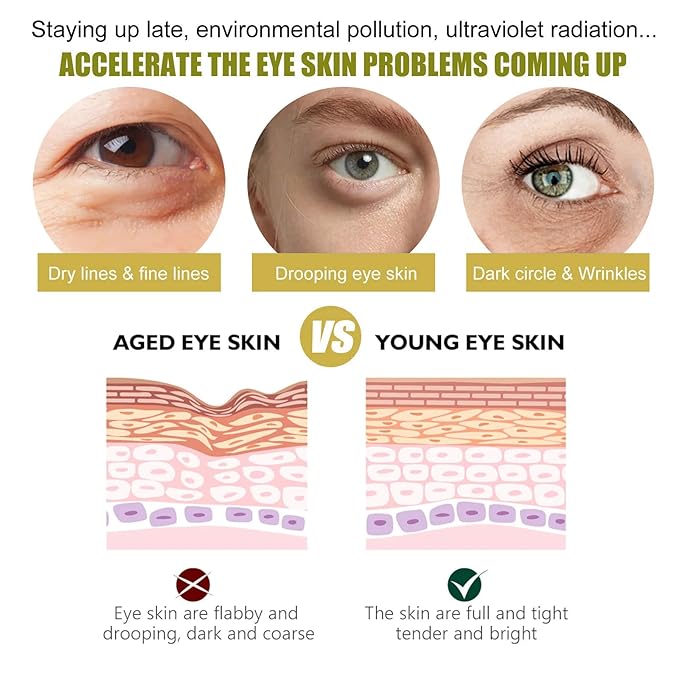 Retinol Eye Cream Anti Aging + 24k Under Eye Patches Kit, Under Eye Patches For Puffy Eyes And Dark Circles, Under Eye Cream With Retinol Serum,Dark Circle Eye Cream For Moisturizing, Firming