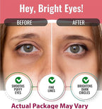 Eye Mask for Puffiness - Under Eye Patches for Dark Circles - Korean Under Eye Mask Patches for Puffy Eyes - Eye Gel Pads Depuffing Eye Brightener with Rose, Caffeine, Hydrogel & Collagen (10 Pairs)