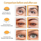 Black Truffle Gold Under Eye Patches - 60pcs Hyaluronic Acid Eye Masks for Moisturizing, Collagen Eye Gel Pads Removing Dark Circles,Wrinkles,Puffiness And Bags