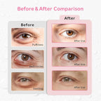 Gel Ice Pack Reusable Cooling Eye Pads and Under Patches,Eye Hot Cold Treatment for Redness,Pain Relief Relax (Butterflies)