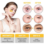 Under Eye Patches, 120 Pcs Golden Under Eye Mask, Eye Treatment Mask for Under Eye Bags, Dark Circles, Puffy Eyes, Fine Lines, Anti-Aging and Anti-Wrinkle, Collagen Eye Mask Skincare