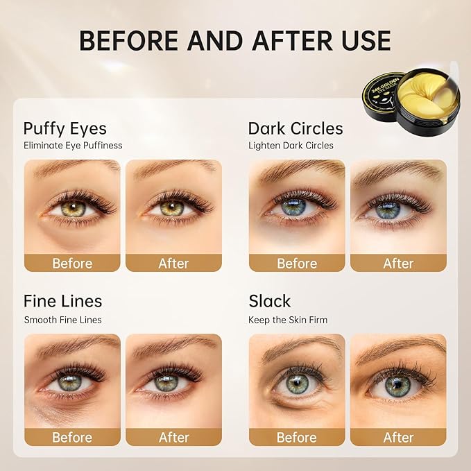 Under eye patches for dark