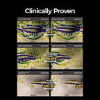 Eyephalt eyebag cream for puffiness,