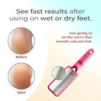 Microplane Colossal Foot File Scraper - The Original Stainless Steel Foot Rasp, Dead Skin/Callus Remover for Feet, Gentle Foot Scrubber, Pedicure Tools for Salon-Quality Foot Care, Pink