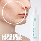 BRIOTECH Skin Renew Toner, Hypochlorous Acid Spray Topical Skin Spray for Face and Skin, Minimize Appearance of Blemishes, Soothing Mist for Redness & Bumps, 4 fl oz ea, 4 ct