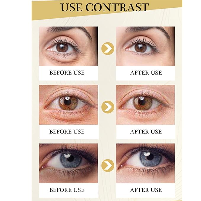 Polypeptide Eye Cream for Dark Circles,Bags Under and Puffiness,Polypeptide Eye Cream Anti Aging Firming Eye Cream,Wrinkie Removal Dark Circles Remove Eye Bags Nourishing Eye Serum Skin Care