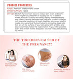 AICHUN BEAUTY Pregnancy Cream Streach Mark Remover Scars Repair Cellulites Lotion Cream 150ml