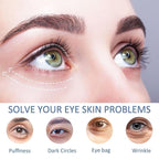 Under Eye Patches For Dark Circles, 12 Pairs Collagen Eye Patches, Natural Marine Collagen Under Eye Patches, Dark Circle Eye Patches, Undereye Mask For Dark Circles, Wrinkles & Eye Bags