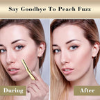 Dermaplane Razor for Women Face with 6 Refill Blades, Dermaplaning Tool Face Razors for Removes Facial Hair, Peach Fuzz, Reusable Metal Handle Eyebrow Razor (Royal Gold)