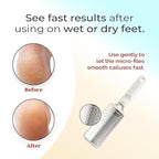 Microplane Colossal Foot File Scraper - The Original Stainless Steel Foot Rasp, Dead Skin/Callus Remover for Feet, Gentle Foot Scrubber, Pedicure Tools for Salon-Quality Foot Care, White