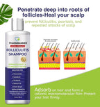 Anti-Fungal Shampoo for Itchy, Dry Scalp – Supports Scalp Health, Helps with Folliculitis, Seborrheic Dermatitis & Scalp Flaking-2 Pack