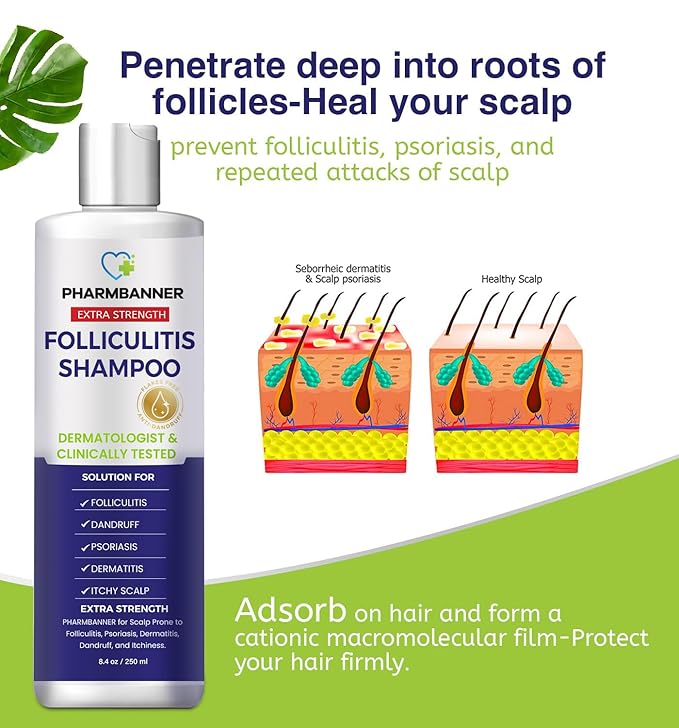 Anti-Fungal Shampoo for Itchy, Dry Scalp – Supports Scalp Health, Helps with Folliculitis, Seborrheic Dermatitis & Scalp Flaking-2 Pack