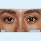 NuFACE IonPlex Hydra-Gel Power Under Eye Patches - Gel Under Eye Mask for Puffy Eyes & Dark Circles - Cooling Wrinkle Patches & Hydrating Treatment Pads to Energize, Brighten & Tighten (60 Count)