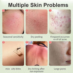 Aloe Vera Gel for Face, Travel Size Aloe Vera Gel, Deep Moisturizing & Repairing Skin, Fast Absorbing, Organic Aloe Vera Soothing Gel for Cooling, Calming and Soothing after Sun Care 1.41 Oz