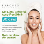 Exposed Skin Care Acne Facial Cleanser - Gentle Face Wash with Salicylic Acid for Acne Prone Skin - Pore Clarifying Acne Treatment for All Ages, Skin Types