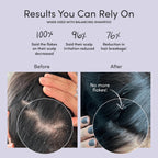 Jupiter Restoring Scalp Serum - Soothing Anti-Dandruff Serum for Men & Women for Flaky, Oily, & Dry Scalp - Restores Barrier and Reduces Breakage & Flakes - Color-Safe, Sulfate-Free, Paraben-Free