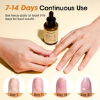 Gellen 30ml Ginger Nail Growth Serum for Nail Strengthener and Growth, Nail Repair Treatment for Weak Brittle Splitting Damaged Nails, Hydrated & Nourished Nail Care Solution for Hands & Feet