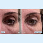 NuFACE IonPlex Hydra-Gel Power Under Eye Patches - Gel Under Eye Mask for Puffy Eyes & Dark Circles - Cooling Wrinkle Patches & Hydrating Treatment Pads to Energize, Brighten & Tighten (60 Count)