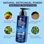 Anti-Fungal Shampoo for Scalp Psoriasis: Dandruff Shampoo for Folliculitis and Seborrheic Dermatitis - Relieves Itchy & Dry Scalp - 300 mL / 10.1 fl.oz