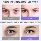 Under eye roller cream for