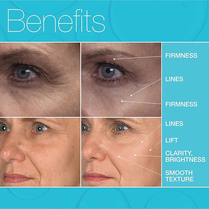 MD Complete Eye Wrinkle Duo | Professional Dermatologist Skin Rejuvenation | includes Wrinkle & Radiance Remedy PLUS with Retinol and Total Eye Treatment with Hyaluronic Acid and Peptides | Set of Two