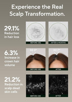 AROMATICA Rosemary Salt Scrub Shampoo - Hair Loss Korean Scalp Detox Shampoo with Rosemary Scalp Oil | Scalp Exfoliator with Salt Scrub for Oily Scalp | Sulfate Free, Silicone Free (10.5 oz / 300g)