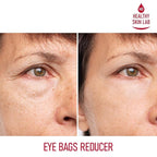 Reusable Under Eye Patches, Reduce Dark Circles, Puffy Eyes, Undereye Bags & Wrinkles - Medical-Grade Silicon Patches Reusable For Up To 3 Weeks