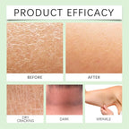 Body Lotion from Korea Whitening Remove Dark Spots, Original Niacinamide Whitening Body Lotion for Dry, Rough & Sensitive Skin, Moisturizing & Nourishing (1)