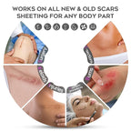 Advanced Scar Cream, 1.7 Oz(50ml) Large